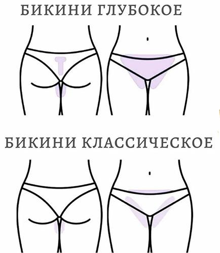 Как бриться без раздражения девушке ноги, зону бикини, подмышки Как бриться без раздражения девушке ноги, зону бикини, подмышки