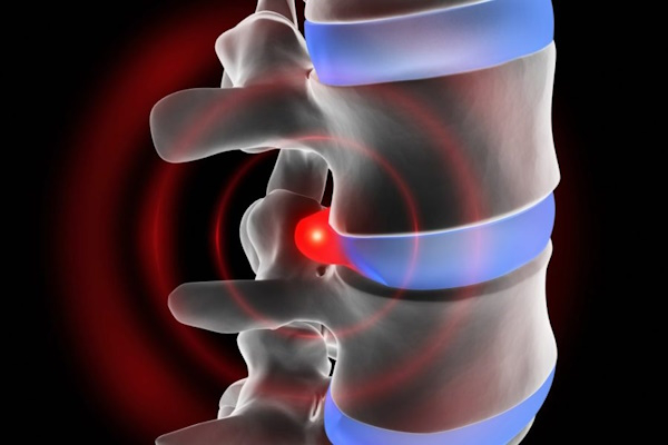 Складка упражнение в гимнастике. На пресс, растяжку, стоя Складка упражнение в гимнастике. На пресс, растяжку, стоя