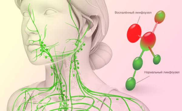 Как разогнать лимфу в организме, убрать отеки, улучшить лимфоотток Как разогнать лимфу в организме, убрать отеки, улучшить лимфоотток
