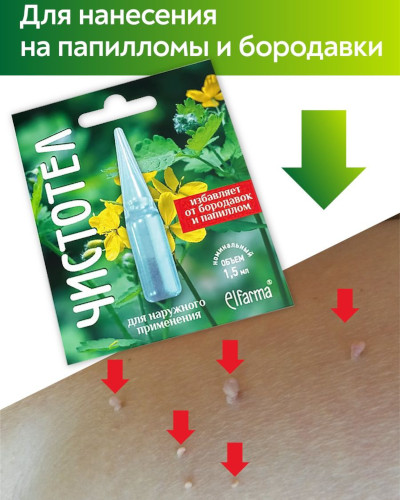 Папилломы под мышками. Причины и лечение, как избавиться Папилломы под мышками. Причины и лечение, как избавиться