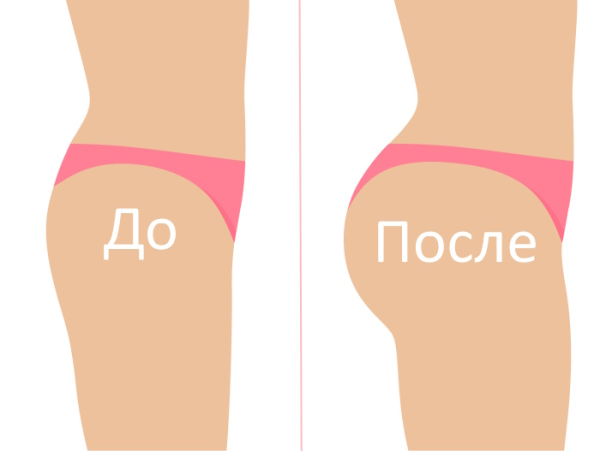 Бразильская попа. Как сделать в домашних условиях Бразильская попа. Как сделать в домашних условиях