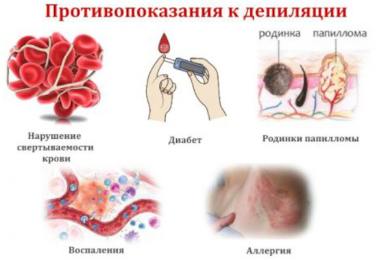Полоски для эпиляции бикини, лица, ног. Как пользоваться Полоски для эпиляции бикини, лица, ног. Как пользоваться