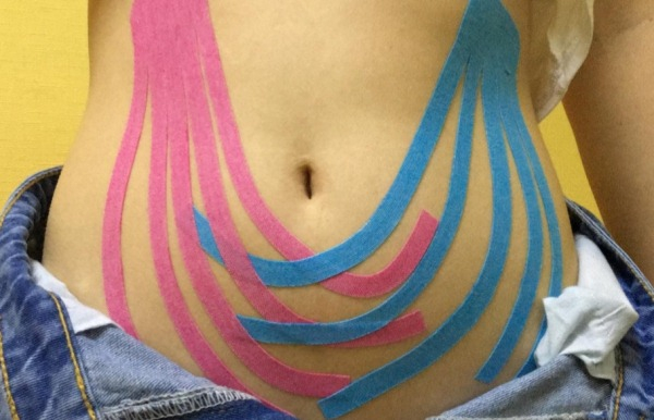 Тейпирование живота и боков для похудения. Схема, как делается, фото, результаты Тейпирование живота и боков для похудения. Схема, как делается, фото, результаты