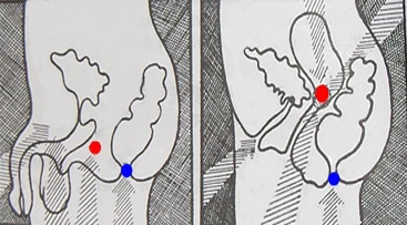 Мула бандха: техника выполнения корневого замка в практике йоги Мула бандха: техника выполнения корневого замка в практике йоги