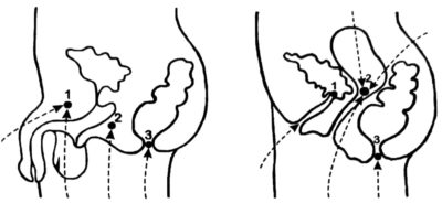 Мула бандха: техника выполнения корневого замка в практике йоги Мула бандха: техника выполнения корневого замка в практике йоги