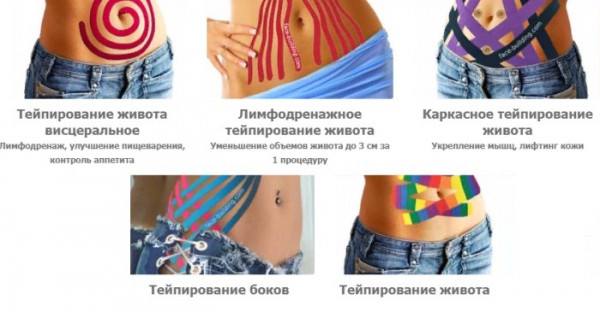Тейпирование живота и боков для похудения. Схема, как делается, фото, результаты Тейпирование живота и боков для похудения. Схема, как делается, фото, результаты